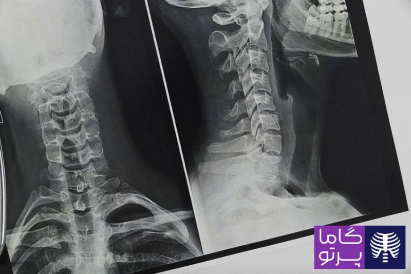 خدمات رادیولوژی در منزل تهران با گاما پرتو 