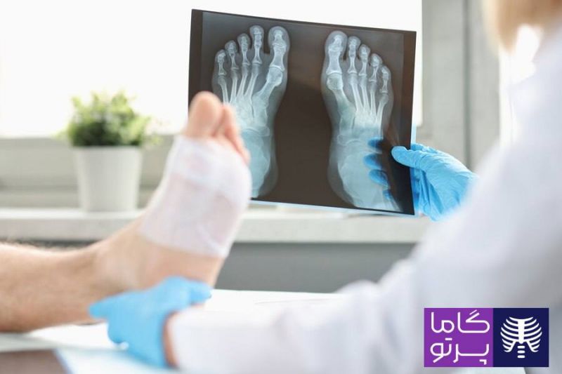رادیولوژی در منزل کرج - گاما پرتو 